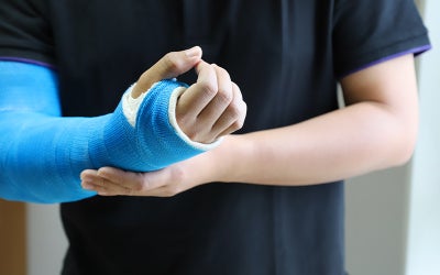 cast on arm